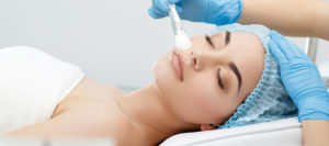 Esthetique-Peeling Dr Thierry Aboudaram