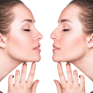 Visage-Rhinoplastie Dr Thierry Aboudaram